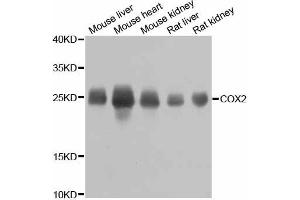 Western blot analysis of extracts of various cell lines, using MT-CO2 antibody. (COX2 Antikörper)
