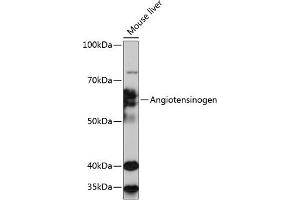 Western blot analysis of extracts of Mouse liver, using Angiotensinogen Rabbit mAb (ABIN7265598) at 1:1000 dilution. (AGT Antikörper)