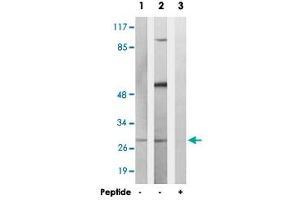 Western blot analysis of extracts from K-562 cells and COS-7 cells, using MARCH3 polyclonal antibody . (MARCH3 Antikörper)