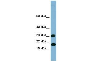 WB Suggested Anti-TRAPPC2L Antibody Titration: 0. (TRAPPC2L Antikörper  (N-Term))