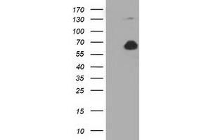 Western Blotting (WB) image for anti-Pyruvate Kinase, Liver and RBC (PKLR) antibody (ABIN1500246) (PKLR Antikörper)