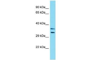 Western Blotting (WB) image for anti-Leiomodin 3 (LMOD3) (N-Term) antibody (ABIN2774556) (LMOD3 Antikörper  (N-Term))