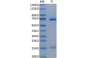 Human PCSK9 on Tris-Bis PAGE under reduced condition. (PCSK9 Protein (AA 31-692) (His tag))