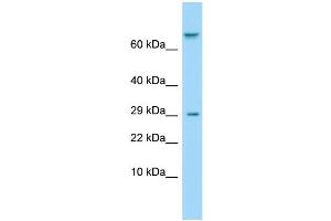 Host: Rabbit Target Name: TAS1R1 Sample Type: ACHN Whole Cell lysates Antibody Dilution: 1. (TAS1R1 Antikörper  (Middle Region))