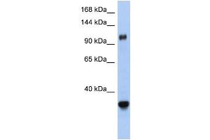 WB Suggested Anti-XPO5 Antibody Titration:  0. (XPO5 Antikörper  (Middle Region))