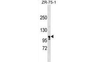 Western Blotting (WB) image for anti-La Ribonucleoprotein Domain Family, Member 1B (LARP1B) antibody (ABIN2999647)