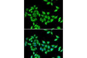 Immunofluorescence analysis of U20S cell using KIF3A antibody. (KIF3A Antikörper)