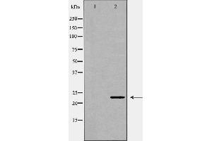 Western blot analysis of lung1  lysate using FGF10 antibody. (FGF10 Antikörper  (C-Term))