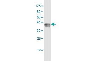 Western Blot detection against Immunogen (36. (TCF7 Antikörper  (AA 287-384))