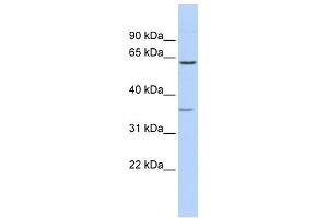 WB Suggested Anti-GBAS Antibody Titration:  0. (GBAS Antikörper  (Middle Region))