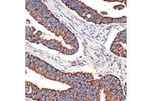 Immunohistochemistry (IHC) image for anti-BCL2-Like 14 (Apoptosis Facilitator) (BCL2L14) antibody (ABIN7265865)