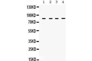 Western Blotting (WB) image for anti-Transforming Growth Factor, beta Receptor II (70/80kDa) (TGFBR2) (AA 96-128), (N-Term) antibody (ABIN3043311) (TGFBR2 Antikörper  (N-Term))