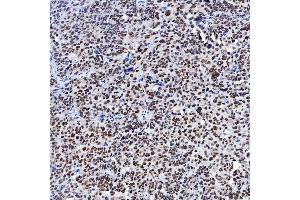 IHC analysis of SF3A1 using anti-SF3A1 antibody (ABIN7600556). (SF3A1 Antikörper  (AA 20-556))