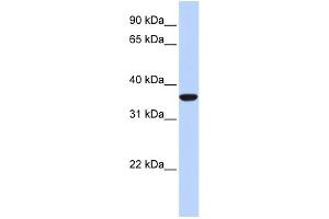 WB Suggested Anti-MAFB Antibody Titration: 0. (MAFB Antikörper  (N-Term))