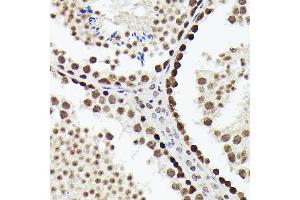 Immunohistochemistry of paraffin-embedded mouse testis using SOX4 antibody (ABIN7270575) at dilution of 1:150 (40x lens). (SOX4 Antikörper  (AA 1-100))