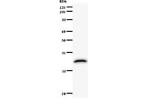 Western Blotting (WB) image for anti-Activating Transcription Factor 3 (ATF3) antibody (ABIN5676162)