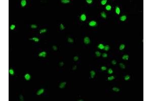 Immunofluorescence staining of U251 cells with ABIN7164153 at 1:166, counter-stained with DAPI.