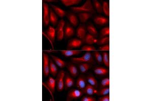 Immunofluorescence analysis of U2OS cells using PSMA5 antibody. (PSMA5 Antikörper  (AA 1-241))