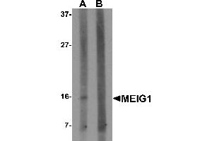 Western blot analysis of MEIG1 in human kidney tissue lysate with MEIG1 antibody at 1 µg/mL in (A) the absence and (B) the presence of blocking peptide. (MEIG1 Antikörper  (C-Term))