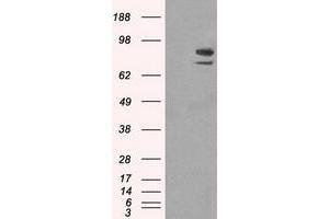 Western Blotting (WB) image for anti-SATB Homeobox 1 (SATB1) antibody (ABIN1500809)