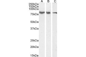 Western Blotting (WB) image for anti-Forkhead Box K2 (FOXK2) (C-Term) antibody (ABIN185049)
