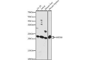 Western blot analysis of extracts of various cell lines, using MED18 antibody (ABIN7268439) at 1:1000 dilution. (MED18 Antikörper  (AA 30-110))