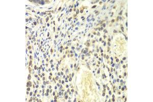 Immunohistochemistry of paraffin-embedded human colon using PSMA4 antibody. (PSMA4 Antikörper)