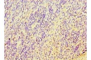 Immunohistochemistry of paraffin-embedded human tonsil tissue using ABIN7171737 at dilution of 1:100 (RAP1 Antikörper  (AA 1-280))