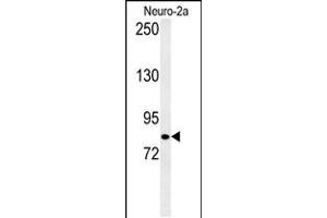 Western blot analysis of CQ028 Antibody in Neuro-2a cell line lysates (35ug/lane) (HID1/DMC1 Antikörper  (C-Term))