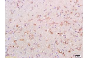 Formalin-fixed and paraffin embedded rat brain labeled with Anti-ATG1/ULK1 Polyclonal Antibody, Unconjugated (ABIN701440) at 1:200 followed by conjugation to the secondary antibody and DAB staining.