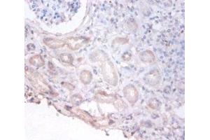 Immunohistochemistry of paraffin-embedded human kidney tissue using ABIN7149438 at dilution of 1:100 (PHGDH Antikörper  (AA 2-251))