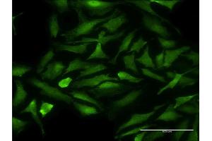 Immunofluorescence of monoclonal antibody to CDK9 on HeLa cell.