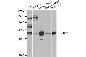 Western blot analysis of extracts of various cell lines, using IGFBP5 antibody (ABIN6292146) at 1:1000 dilution.