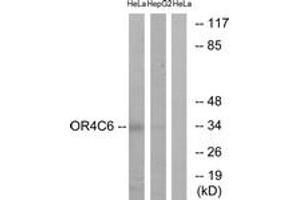 Western blot analysis of extracts from HeLa/HepG2 cells, using OR4C6 Antibody.