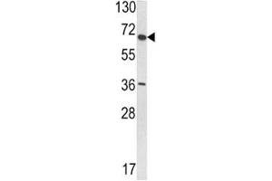Western blot analysis of VDU1 antibody and T47D lysate. (USP33 Antikörper  (AA 799-829))