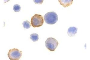 Immunocytochemistry of Bmf in HeLa cells with AP30157PU-N Bmf antibody at 10 μg/ml.