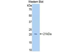 Western blot analysis of the recombinant protein. (GAS6 Antikörper  (AA 356-511))