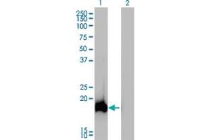 Western Blot analysis of AHNAK expression in transfected 293T cell line by AHNAK monoclonal antibody (M01), clone 3G7. (AHNAK Antikörper  (AA 1-100))