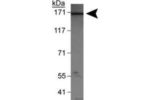 Western blot analysis of WHSC1L1 (isoform 1) in HeLa nuclear extracts with WHSC1L1 polyclonal antibody . (WHSC1L1 Antikörper  (AA 300-400))