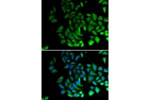 Immunofluorescence (IF) image for anti-Piwi-Like 1 (PIWIL1) antibody (ABIN6219364) (PIWIL1 Antikörper)