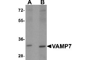 Western blot analysis of VAMP7 in mouse lung tissue lysate with VAMP7 antibody at 1 µg/mL.