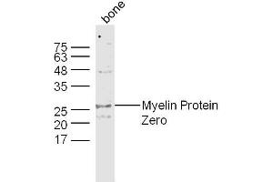 Bone lysates probed with Myelin Protein Zero Polyclonal Antibody, Unconjugated  at 1:300 dilution and 4˚C overnight incubation. (MPZ Antikörper  (AA 175-248))