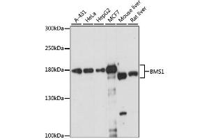 Western blot analysis of extracts of various cell lines, using BMS1 antibody (ABIN6292658) at 1:1000 dilution. (BMS1 Antikörper)