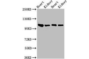 Western Blot Positive WB detected in: Rat heart tissue, Rat kidney tissue, Mouse heart tisseu, Mouse kidney tissue All lanes: ITGA6 antibody at 3 μg/mL Secondary Goat polyclonal to rabbit IgG at 1/50000 dilution Predicted band size: 127, 120, 123, 122, 125, 107 kDa Observed band size: 100 kDa (ITGA6 Antikörper  (AA 625-866))
