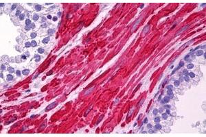 Anti-LDLRAP1 antibody IHC staining of human prostate, smooth muscle. (LDLRAP1 Antikörper  (AA 1-264))