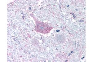 Anti-MRGPRD antibody IHC of human brain, medulla. (MRGPRD Antikörper  (Cytoplasmic Domain))