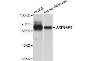 Western blot analysis of extract of HepG2 and mouse pancreas cells, using ARFGAP3 antibody. (ARFGAP3 Antikörper)
