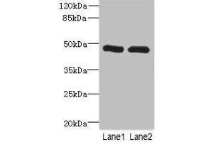 Western blot All lanes: HGDantibody at 2. (HGD Antikörper  (AA 226-445))