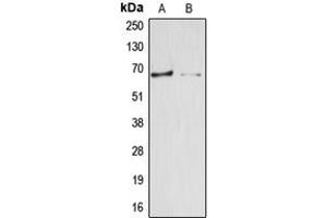 Western blot analysis of Arylsulfatase E expression in HepG2 (A), HEK293T (B) whole cell lysates.