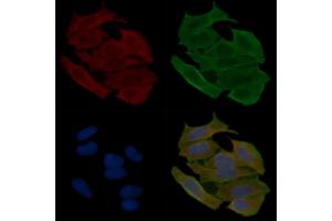 ABIN6262729 and ABIN6278925 staining Hela cells(30 min of UV treatment) by IF/ICC. (Keratin 6 Antikörper  (C-Term))